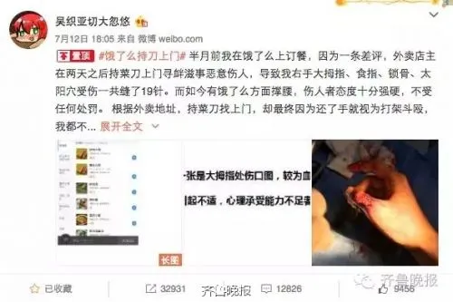 男子给差评被砍伤 骂了一句“操你妈”被尾随砍数刀